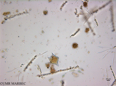 phyto/Guinea golf/Wouri_estuary_ZD-ZD1-ZD2-ZD3/YNkouefuthNfongmo_these 2022-2023/Protoperidinium oceanicum (old Protoperidinium sp4 and oblongum -ZD1_SURF_2023_iden8230621_001_ovl).TIF(copy)_thumb.jpg